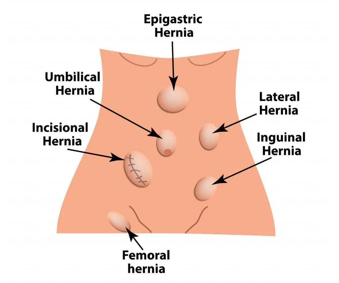 Healthcare consultation