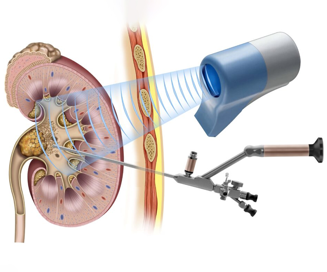 Healthcare consultation