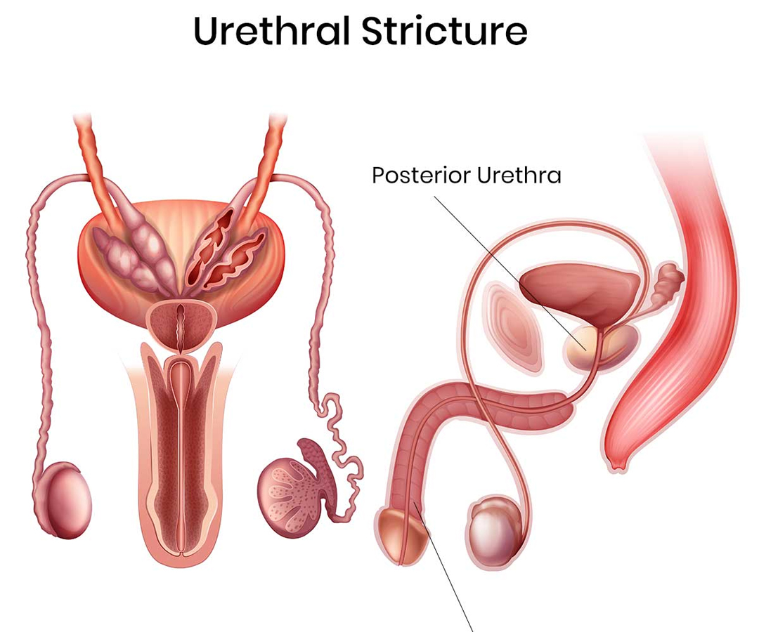 Healthcare consultation