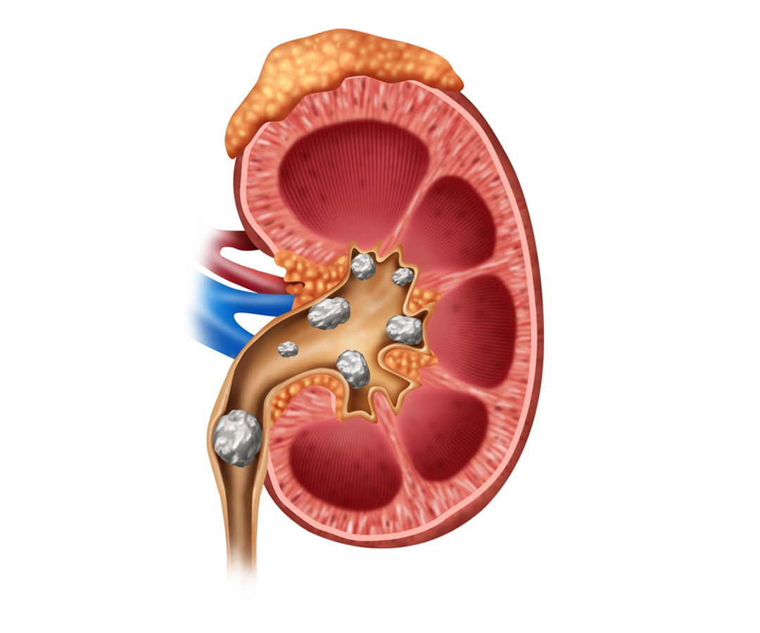 Healthcare consultation